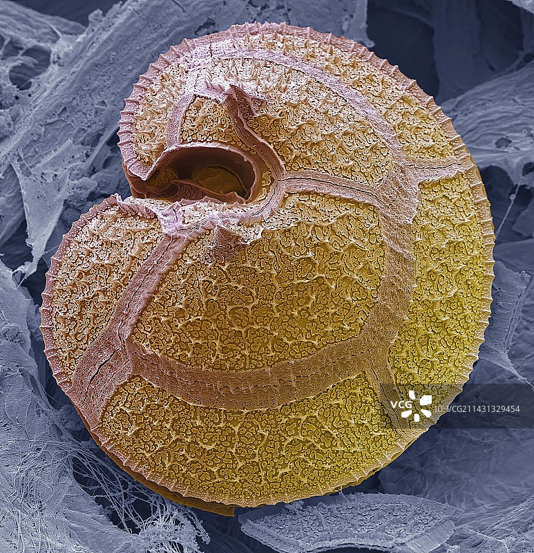 甲藻扫描电镜图图片素材