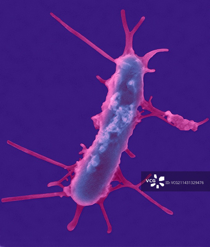 黑海厌氧细菌扫描电镜图图片素材