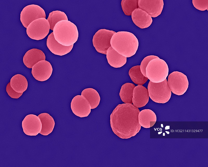 脑膜炎奈瑟菌，球菌原核生物，扫描电子显微镜图片素材