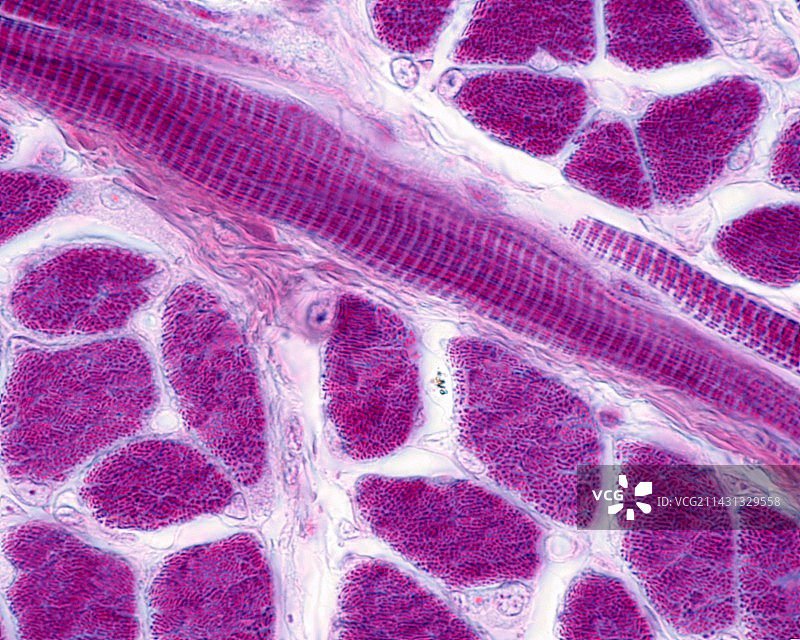 条纹骨骼肌纤维，光学显微照片图片素材