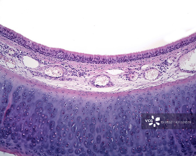 气管显微照片图片素材