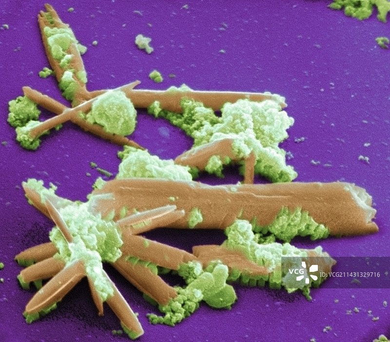 排气颗粒物图片素材