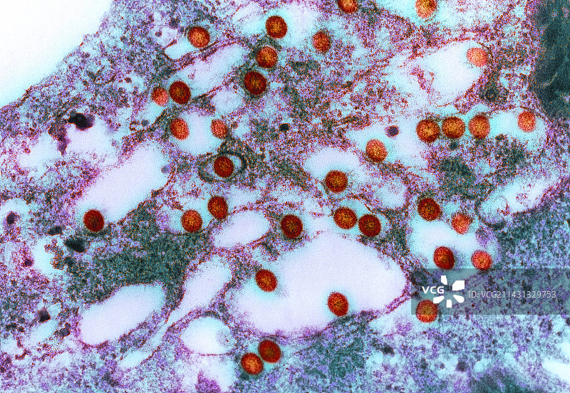 裂谷热病毒，TEM图片素材