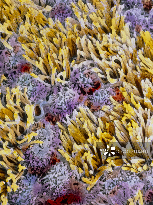 输卵管上皮的伪色彩扫描电镜图图片素材