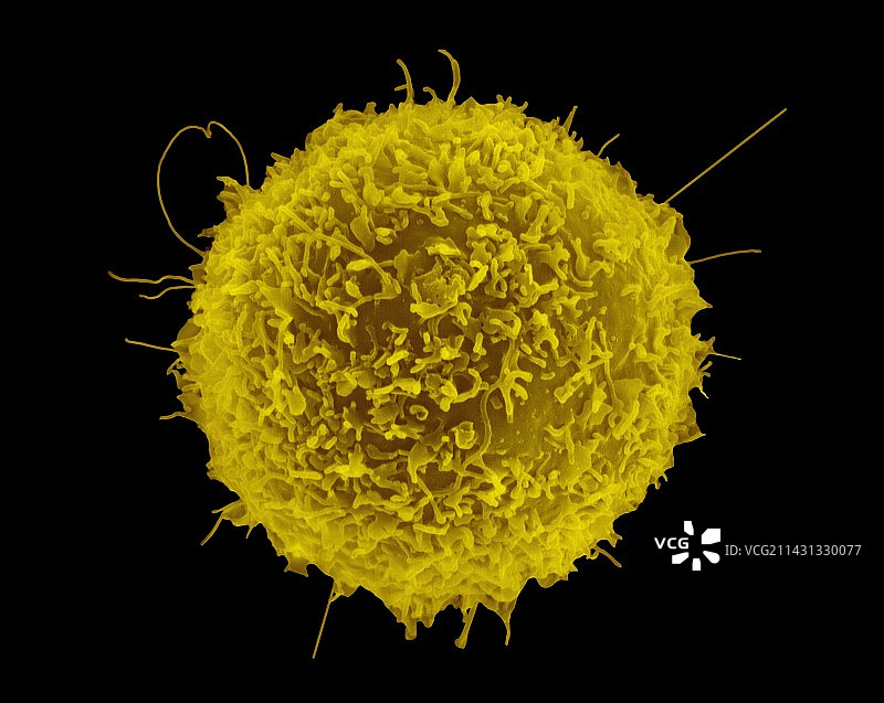 人T淋巴细胞，扫描电子显微镜图片素材