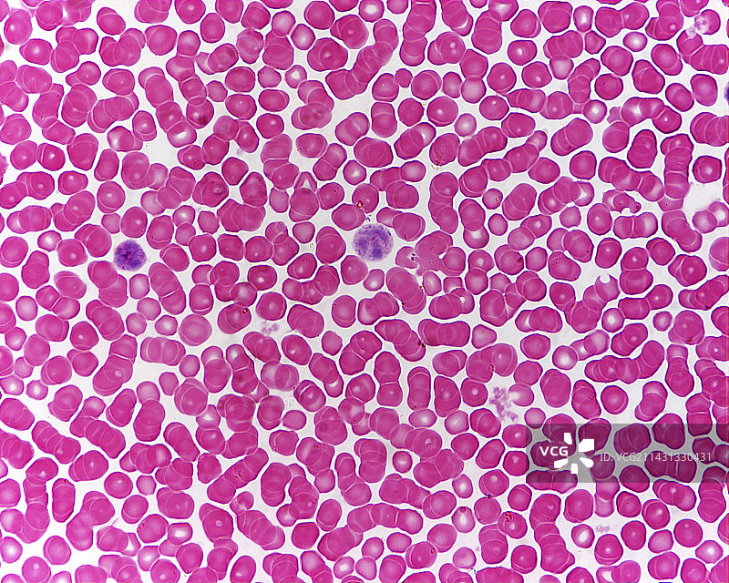 血细胞显微照片图片素材