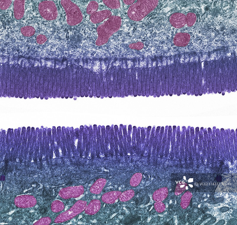 肠道微绒毛，透射电镜图片素材