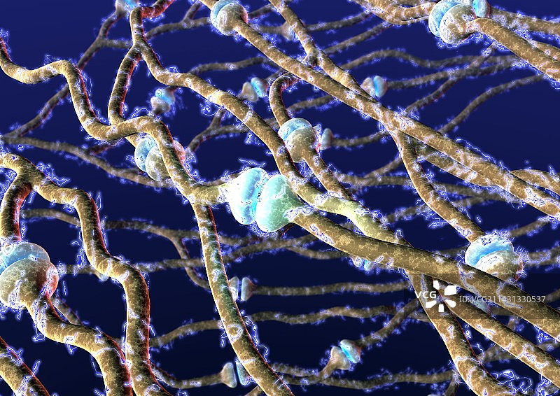 神经超载图片素材