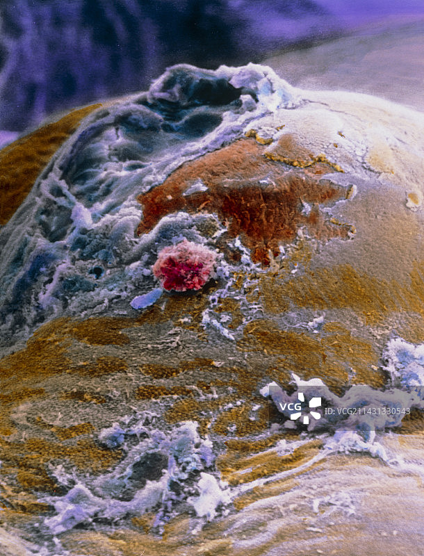 排卵期卵巢表面的假彩色扫描电镜图图片素材