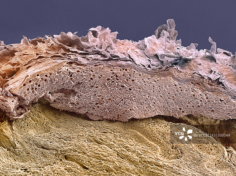 皮肤,扫描电镜图片素材