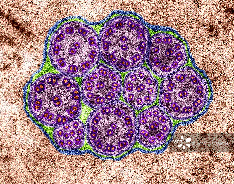 上皮纤毛微管（横截面），TEM图片素材