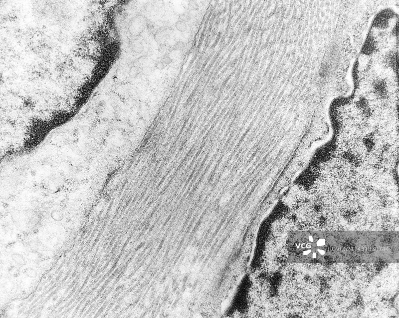 胶原纤维，TEM图片素材