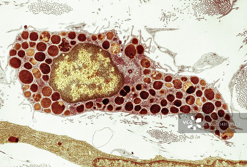 肥大细胞,TEM图片素材