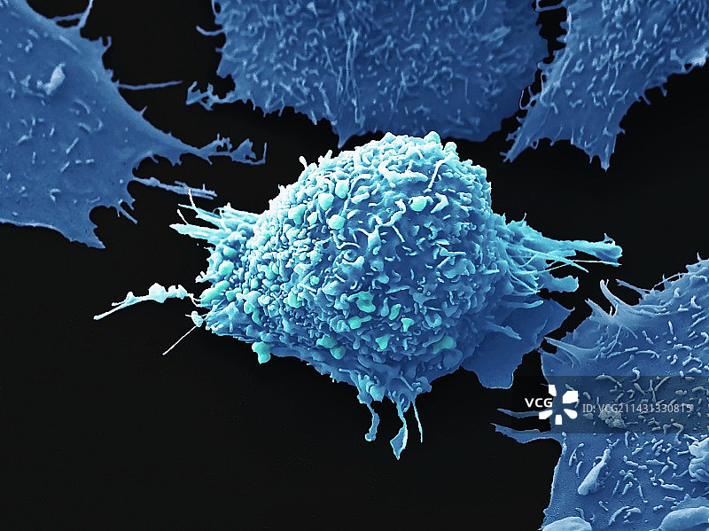 肺癌细胞扫描电镜图图片素材