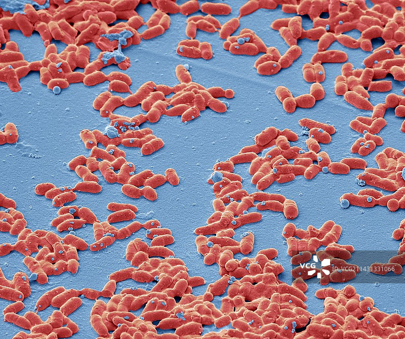 白喉棒状杆菌SEM图像图片素材