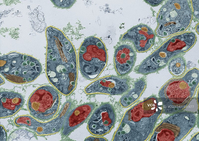 弓形虫寄生虫（透射电镜）图片素材