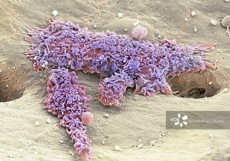 肝脏巨噬细胞扫描电镜图片素材