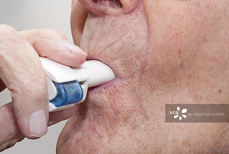 用于缓解慢性阻塞性肺病的茚达特罗吸入剂图片素材