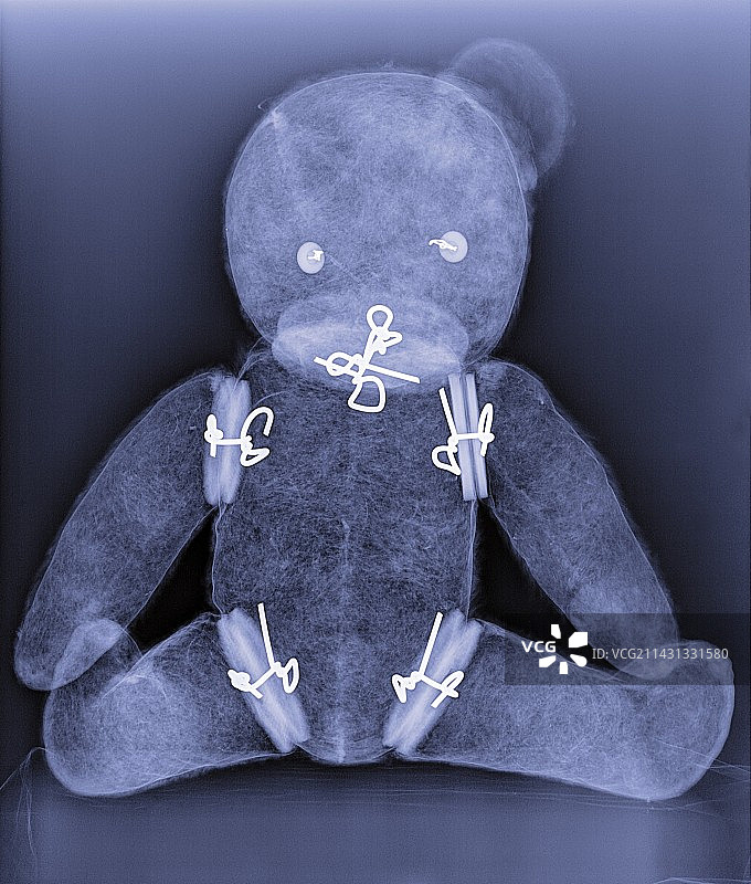 泰迪熊X光片图片素材