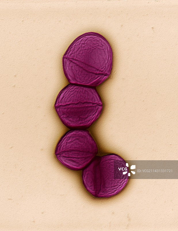 无乳链球菌细菌扫描电镜图像图片素材