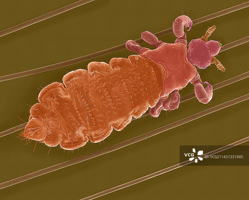 人发上的头虱（扫描电镜图）图片素材