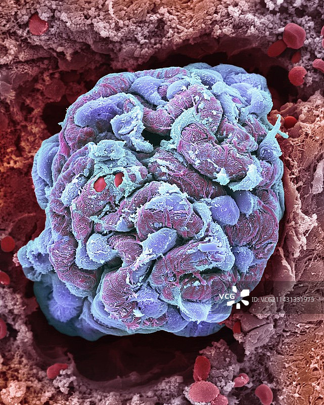 肾小球扫描电镜图图片素材