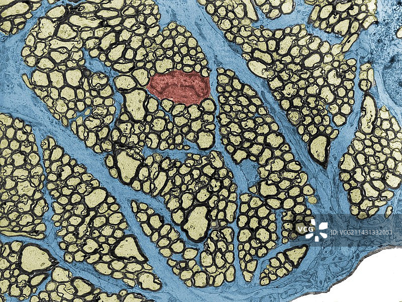 视神经，TEM图片素材