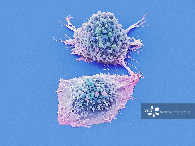 肺癌细胞扫描电镜图图片素材