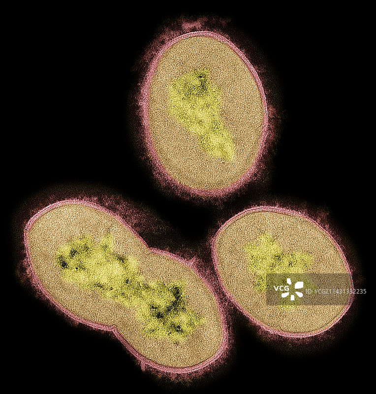 链球菌（透射电镜）图片素材