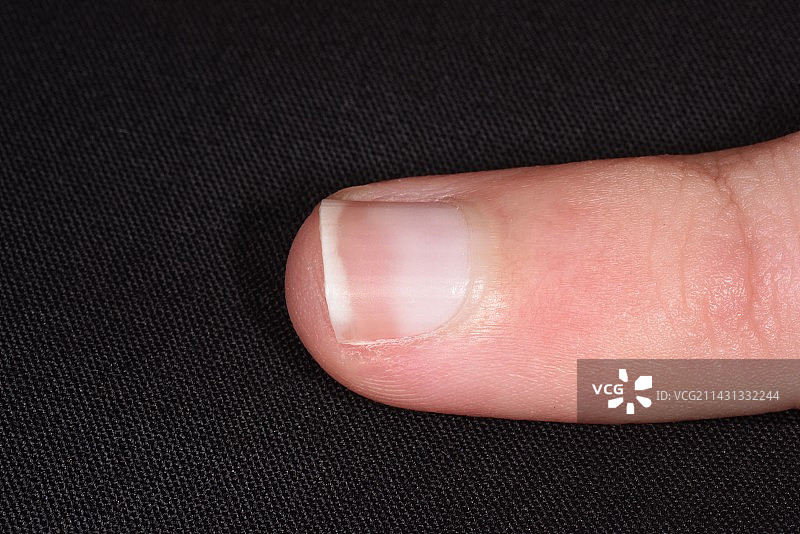 白色指甲图片素材