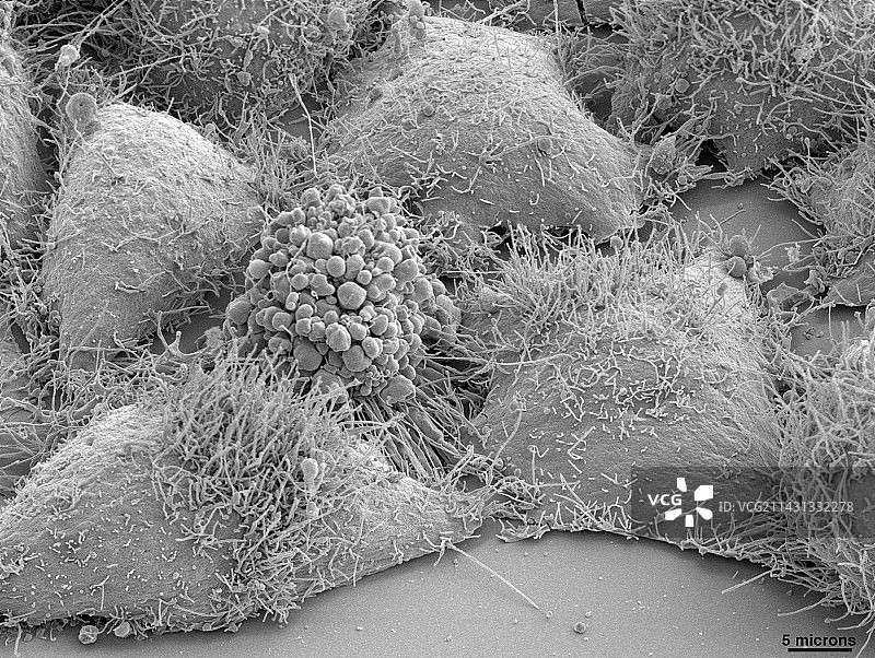 HeLa细胞，扫描电镜图片素材