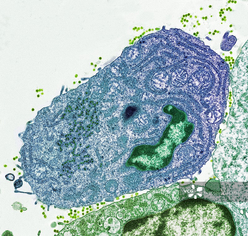 杂交瘤细胞，透射电镜图片素材