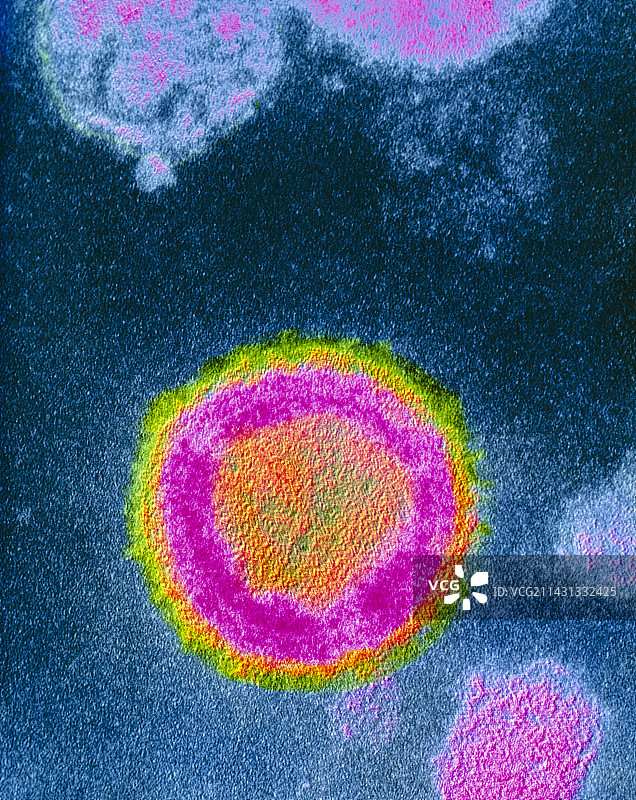 导致艾滋病的HIV-2病毒的伪彩色透射电镜图像图片素材