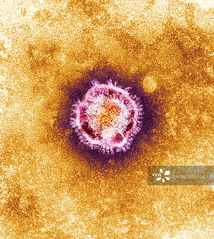 SARS病毒，透射电子显微镜图片素材