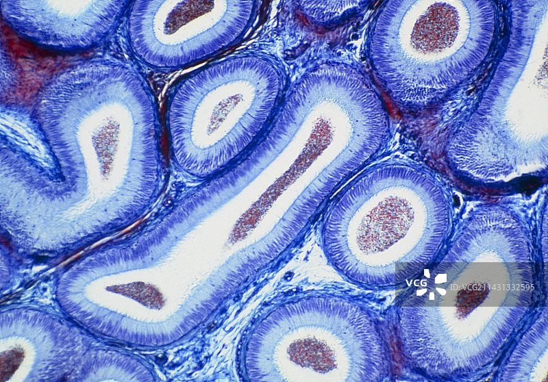 正常人附睾的显微照片图片素材