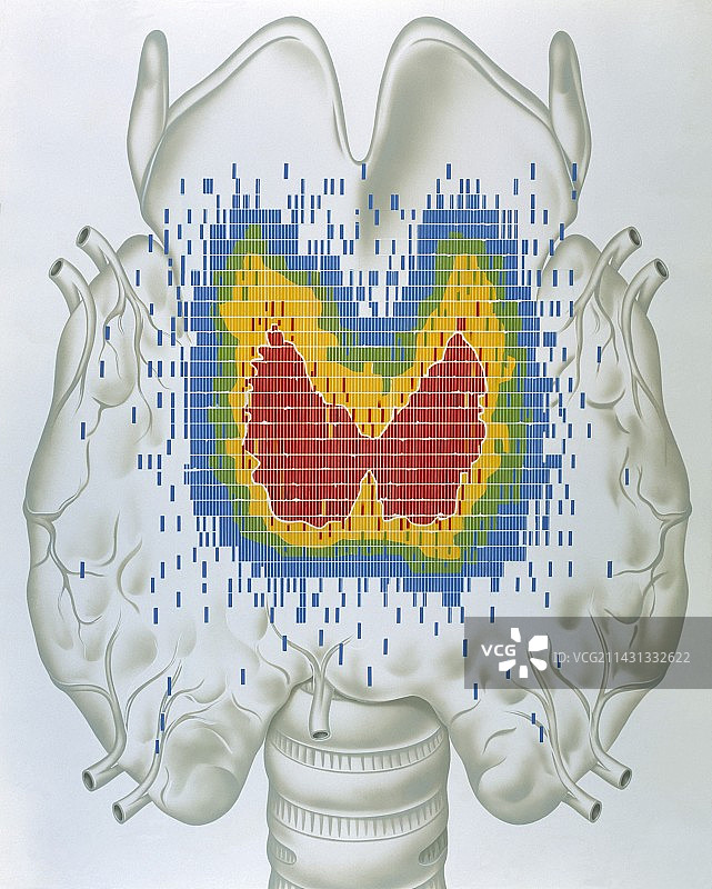 甲状腺图片素材