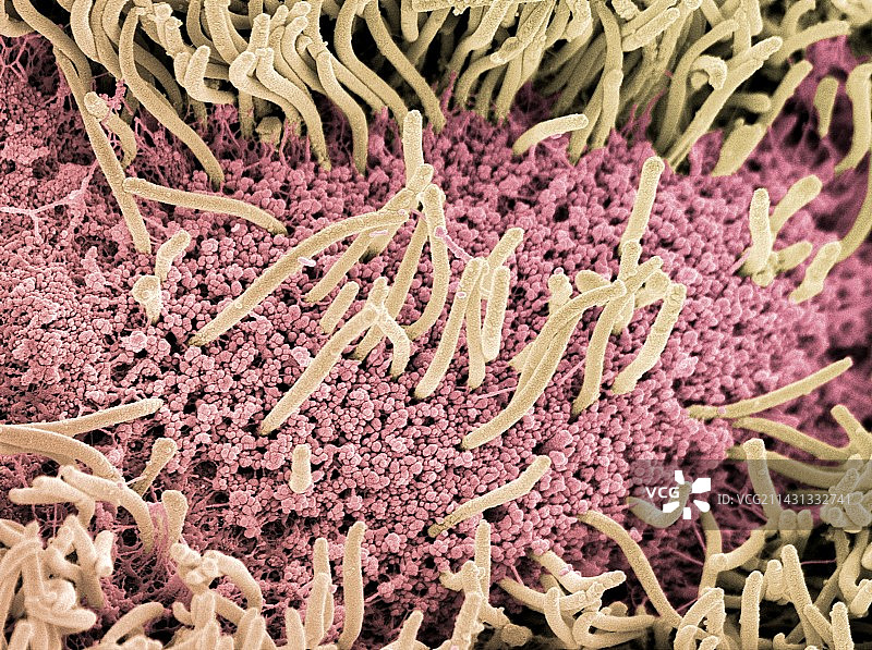 蛞蝓腹面扫描电镜图图片素材