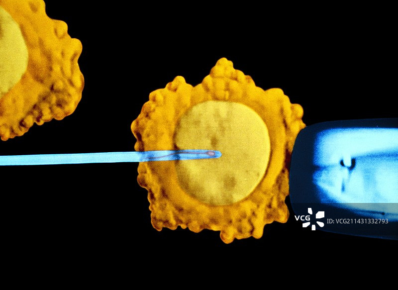 试管婴儿治疗图片素材