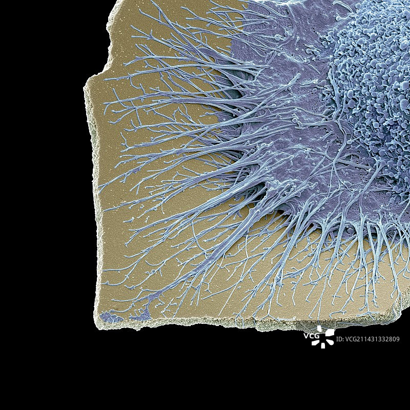 小胶质细胞白细胞扫描电镜图图片素材