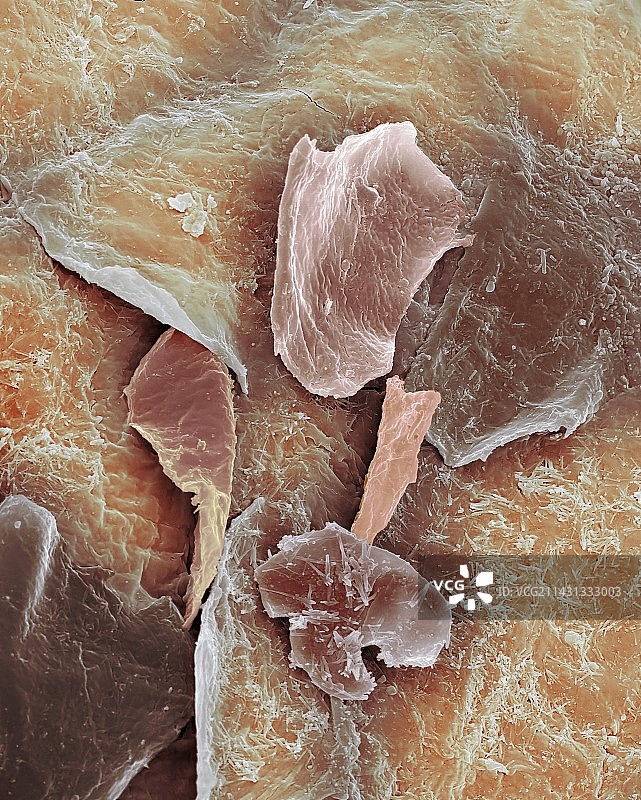 死皮，扫描电子显微镜图片素材