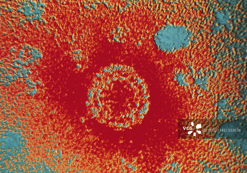 乙型肝炎病毒颗粒的伪彩色透射电镜图图片素材