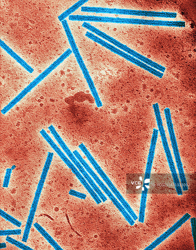 烟草花叶病毒TEM图片素材