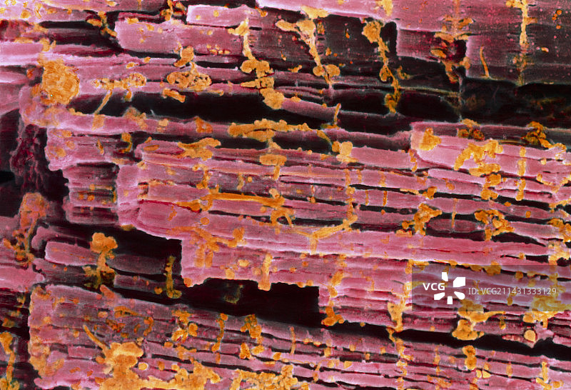 彩色电镜下的人体横纹肌图片素材