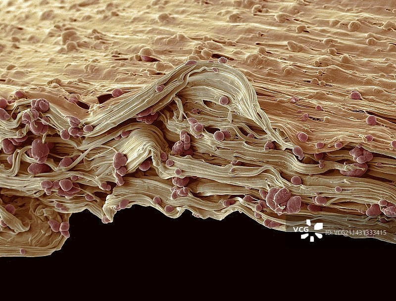 可生物降解的购物袋，扫描电镜图片素材