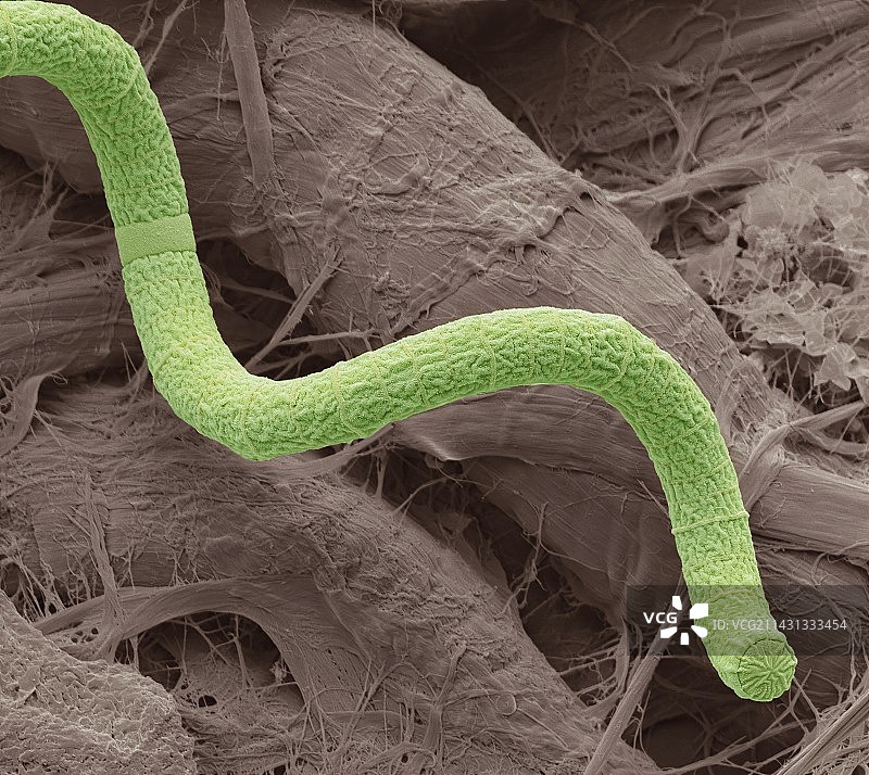 螺旋藻蓝细菌扫描电镜图图片素材