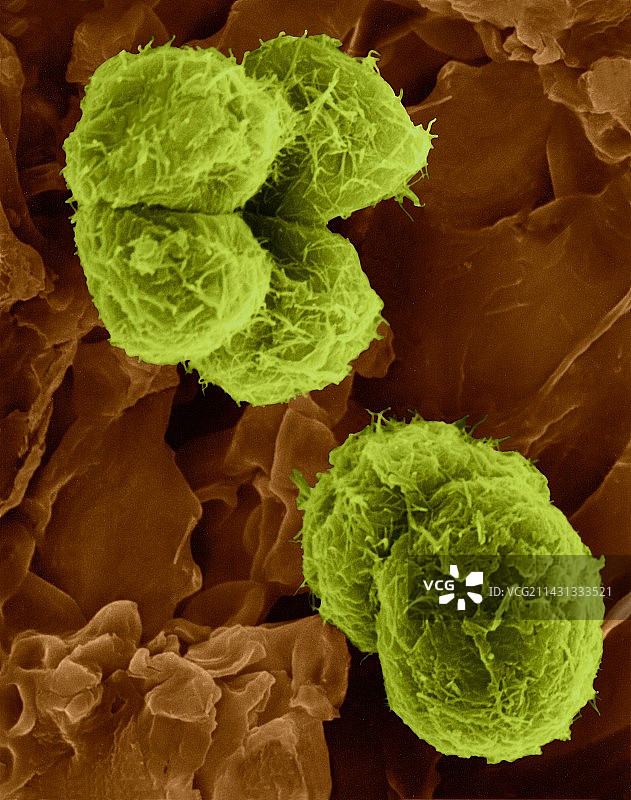 树皮上的绿藻（Protococcus sp.），扫描电镜图图片素材