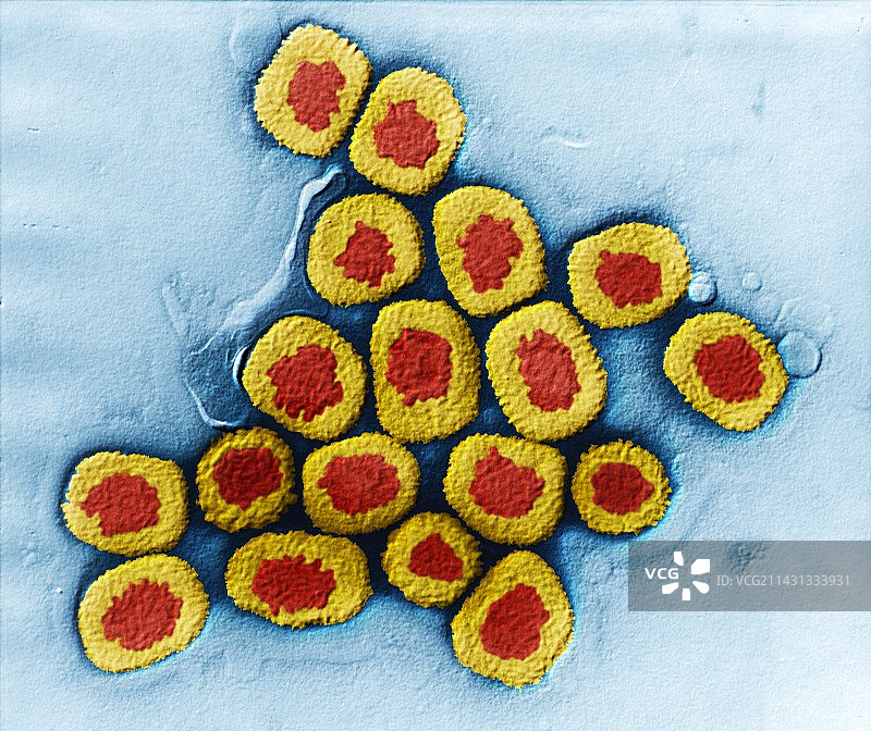 天花病毒，TEM图片素材