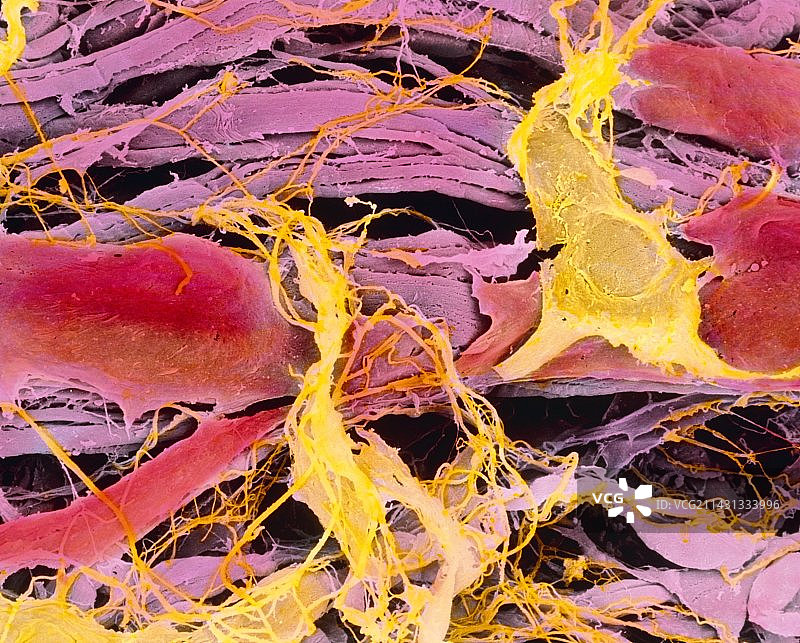 人输卵管平滑肌的彩色扫描电镜图图片素材