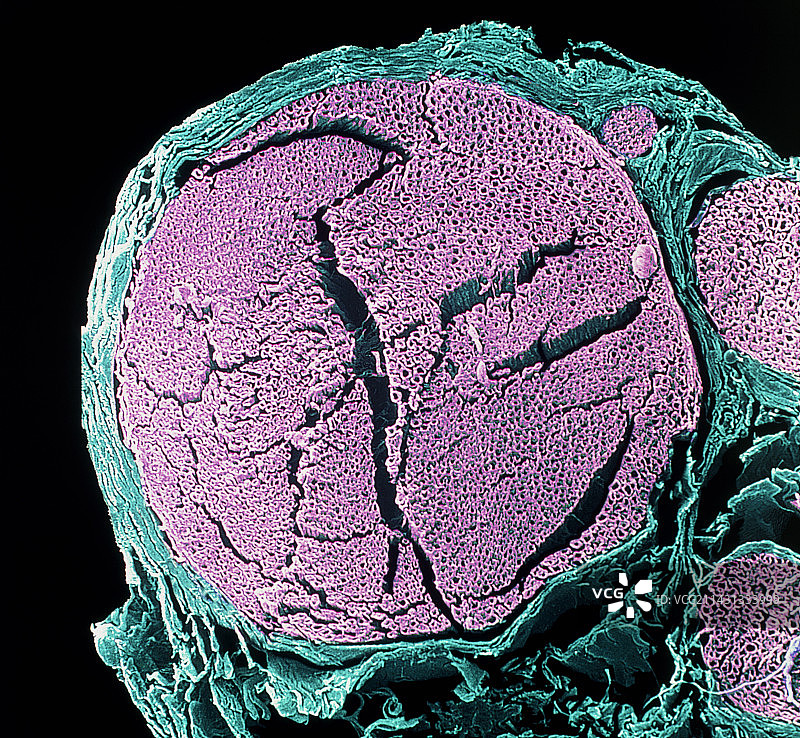 神经纤维及其神经束膜的彩色扫描电镜图图片素材