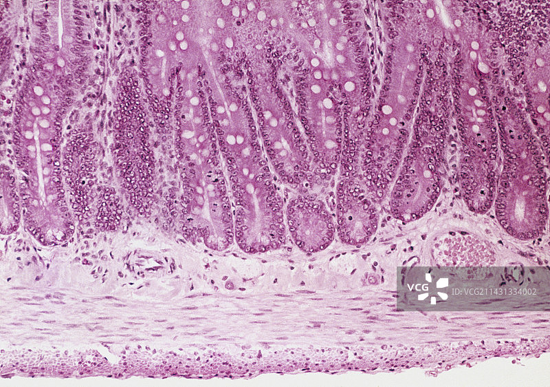 小肠壁切片的光学显微镜图像图片素材